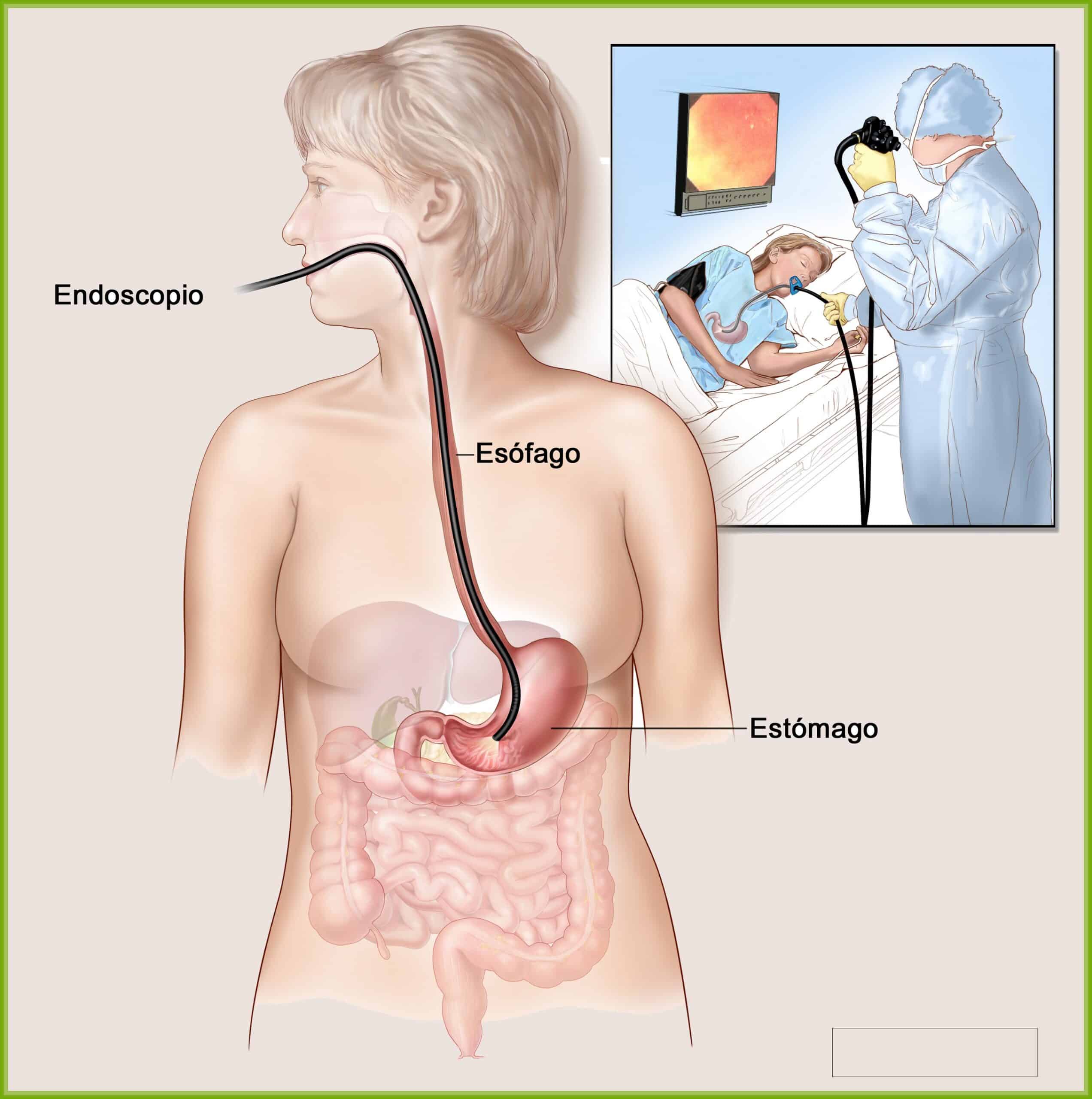 Endoscopia digestiva alta