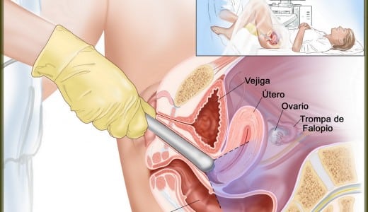 eco vaginal