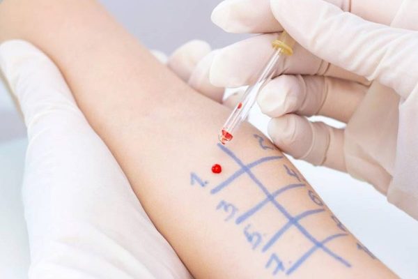 Test De Alergia De: Cefazolina-TLH