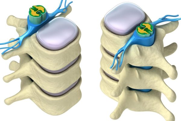 Test De Función Hematopoyética: Mielograma